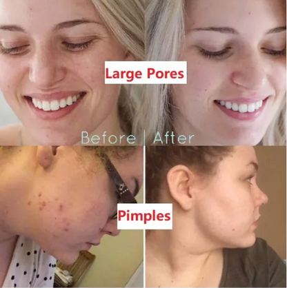 [Buy 1 Get 1 Free] - Green Tea Deep Cleansing Mask [Last Day!