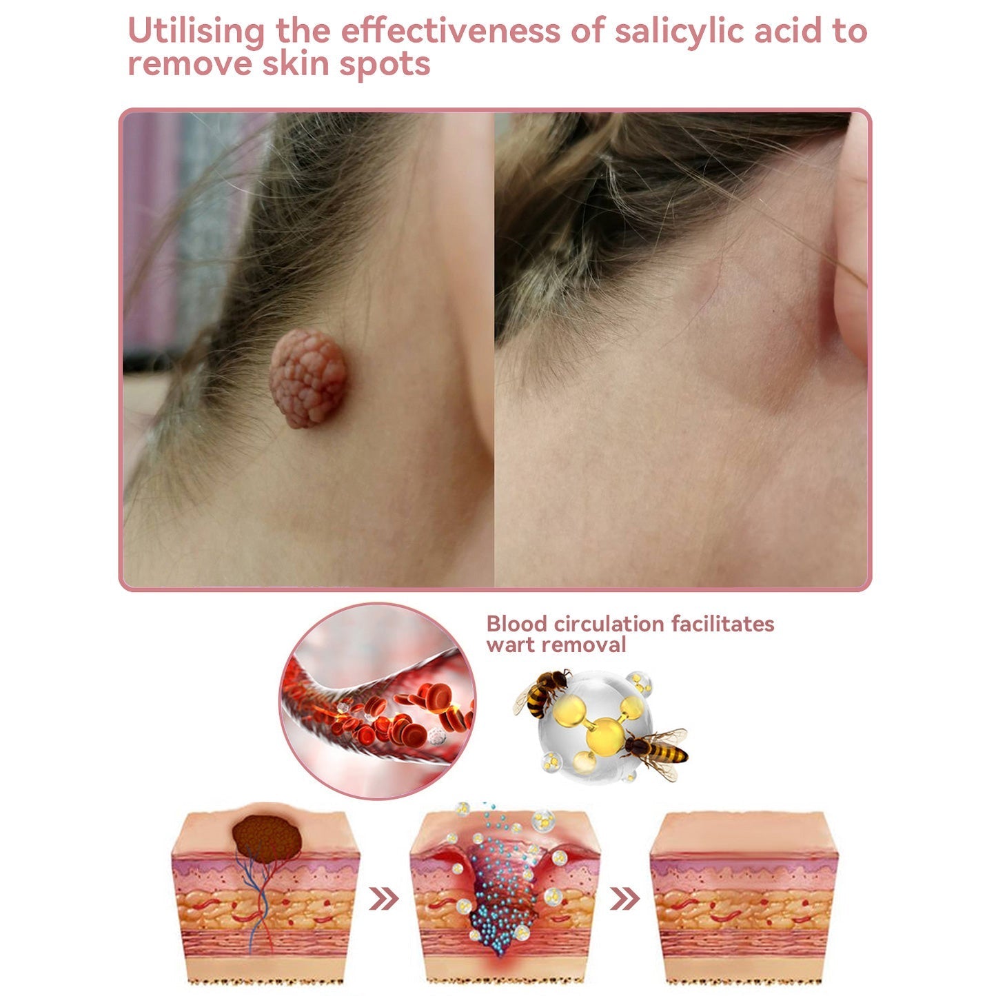 Insideefy™ Radiant Jelly Cream【Up to 50% Off, Featured in Australia News】