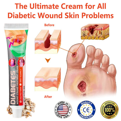 ✨HZA™ Diabetes Wound Strong Treatment Cream