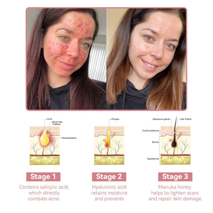 Insideefy™ Radiant Jelly Cream【Up to 50% Off, Featured in Australia News】