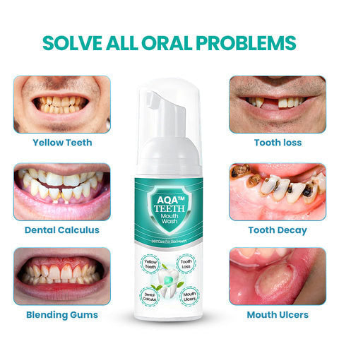 🦷 BUY 2 GET 2 FREE 🦷NEW TEETH Mouthwash - Solve all Oral Problems