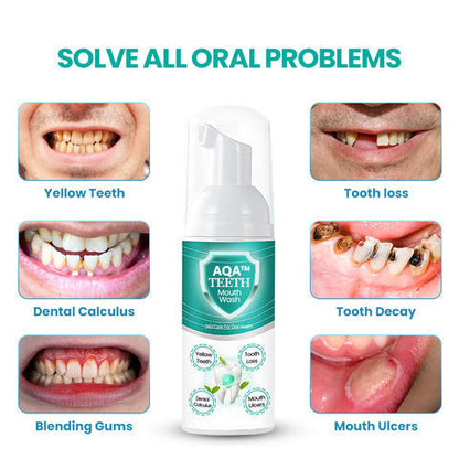 🦷 BUY 2 GET 2 FREE 🦷NEW TEETH Mouthwash - Solve all Oral Problems