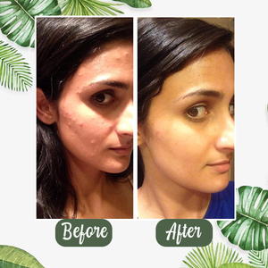 [Buy 1 Get 1 Free] - Green Tea Deep Cleansing Mask [Last Day!