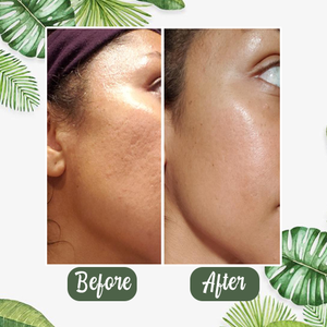 [Buy 1 Get 1 Free] - Green Tea Deep Cleansing Mask [Last Day!