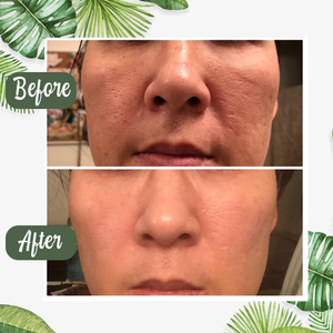 [Buy 1 Get 1 Free] - Green Tea Deep Cleansing Mask [Last Day!